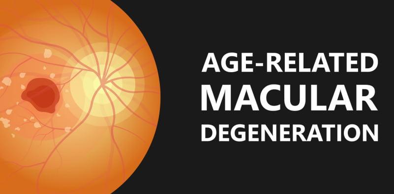 A Closer Look At Age-Related Macular Degeneration Prevention - Family ...